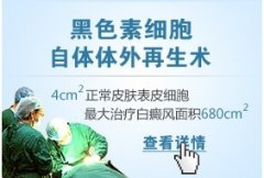 自体表皮细胞自体体外再生术:治疗大面积白斑