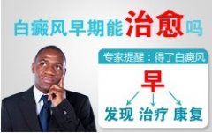治疗白癜风勿半途而废 遵循医嘱是关键