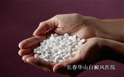 治疗白癜风的药物怎么使用