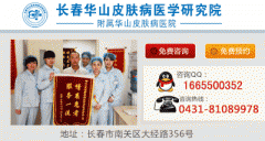 长春哪里治白癜风好