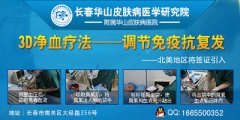 白癜风有哪些治疗误区