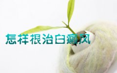 白癜风初期如何治疗