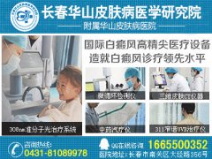 长春哪里白癜风治的好