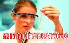 哪些治疗方法治白癜风