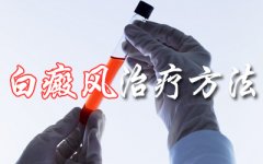 白癜风治疗误区有哪些