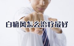 怎样治疗白癜风最有效