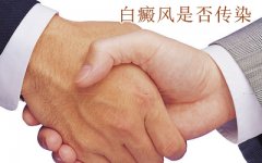 白癜风到底会不会传染