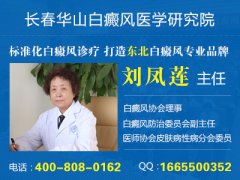 长春治白癜风哪里好
