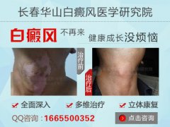 长春博润医院好吗