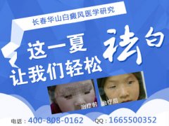 小孩白癜风会出现哪些症状