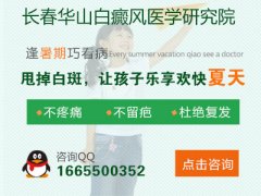 儿童白癜风怎么治好