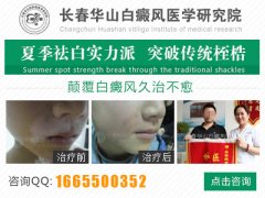 白癜风早期有什么症状表现