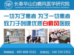 长春白癜风医院哪家好