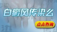 白癜风的传染